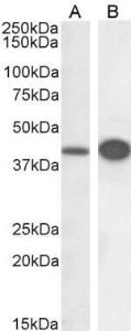 Anti-DAP3 Antibody (A83221) (03 µg/ml) staining of HeLa (A) and HepG2 (B) cell lysate (RIPA buffer, 30 µg total protein per lane) Detected by chemiluminescence