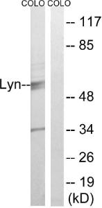 Anti-Lyn Rabbit Polyclonal Antibody