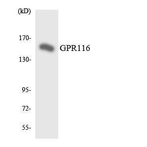 Western blot analysis of the lysates from HeLa cells using Anti-GPR116 Antibody