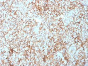 Immunohistochemical analysis of formalin-fixed, paraffin-embedded human tonsil using Anti-CD73 Antibody [NT5E/2503]