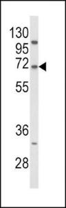 Anti-Proprotein Convertase Subtilisin Kexin 9 Rabbit Polyclonal Antibody (FITC (Fluorescein))