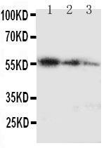 Anti-Ki67 Rabbit Polyclonal Antibody