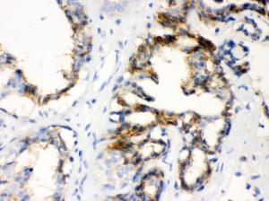 Anti-CTGF Rabbit Polyclonal Antibody