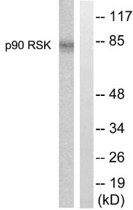 Western blot analysis of lysates from 293 cells, treated with PMA 125ng/ml 30' using Anti-p90 RSK Antibody. The right hand lane represents a negative control, where the antibody is blocked by the immunising peptide.