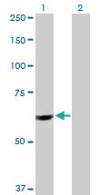 Anti-PTBP1 Rabbit Polyclonal Antibody