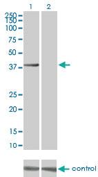 Anti-AURKB Mouse Monoclonal Antibody [clone: 6G8]