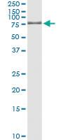 Anti-GTF2A1L Antibody Pair