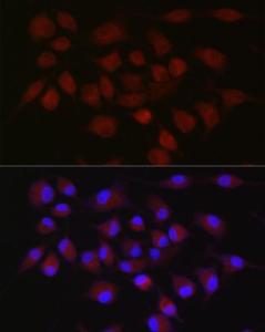 Antibody anti-BIRC3 100 µl