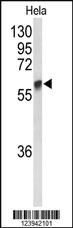 Anti-GALNT2 Rabbit Polyclonal Antibody