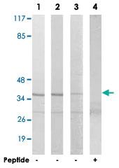 Anti-MNAT1 Rabbit Polyclonal Antibody