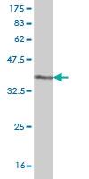 Anti-TLR7 Mouse Monoclonal Antibody [clone: 2F6]