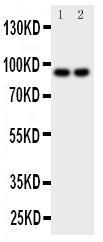 Anti-MALT1 Rabbit Polyclonal Antibody