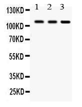 Anti-CYLD Rabbit Polyclonal Antibody