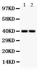 Anti-SFRP4 Polyclonal Antibody