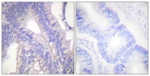 Anti-Lyn Rabbit Polyclonal Antibody