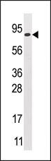 Anti-MOGS Rabbit Polyclonal Antibody