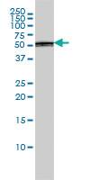 Anti-PTBP1 Mouse Monoclonal Antibody [clone: 3H8]