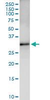 Anti-CDK5 Polyclonal Antibody Pair