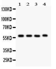 Anti-CYP1A1 Rabbit Polyclonal Antibody