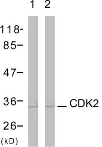 Western blot analysis of lysates from A2780 cells using Anti-CDK2 Antibody. The right hand lane represents a negative control, where the Antibody is blocked by the immunising peptide