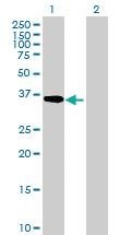 Anti-ADH5 Mouse Polyclonal Antibody