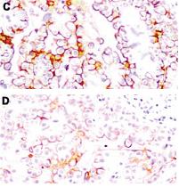 Anti-MSLN Mouse Monoclonal Antibody [clone: MB-G10]