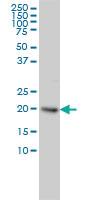 Anti-UBE2H Mouse Monoclonal Antibody [clone: 3C4-1A2]