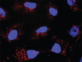 Anti-KIT + PLCG1 Antibody Pair