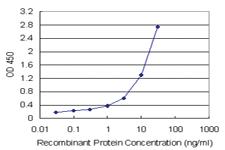 Anti-ZNF397 Polyclonal Antibody Pair