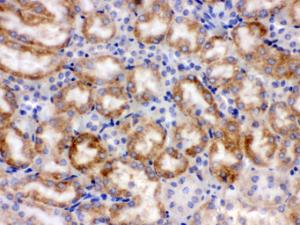 Anti-CYP1A1 Rabbit Polyclonal Antibody