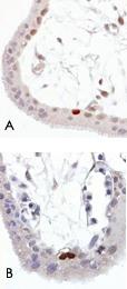 Anti-TP53 Mouse Monoclonal Antibody [clone: FP3.2 [FPS392]]