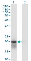 Anti-UBE2H Mouse Monoclonal Antibody [clone: 3C4-1A2]