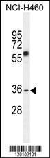 Anti-VSTM4 Rabbit Polyclonal Antibody (Biotin)