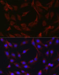 Antibody anti-BIRC3 100 µl