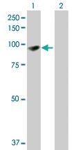 Anti-EPB41L1 Mouse Polyclonal Antibody