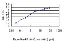 Anti-AURKB Mouse Monoclonal Antibody [clone: 6G8]