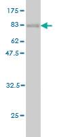 Anti-AKT1 Mouse Monoclonal Antibody [clone: 6C8]