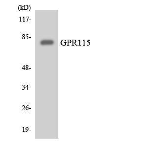 Western blot analysis of the lysates from Jurkat cells using Anti-GPR115 Antibody