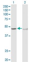 Anti-ADH5 Rabbit Polyclonal Antibody