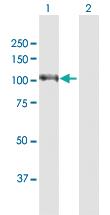 Anti-EPB41L1 Rabbit Polyclonal Antibody