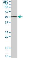 Anti-DGAT1 Goat Polyclonal Antibody