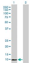 Anti-COX6B2 Rabbit Polyclonal Antibody