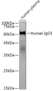 Western blot analysis of extracts of human plasma, using Anti-Human IgG Antibody [ARC2243] (A309060) at 1:3,000 dilution