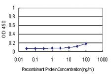 Anti-TSPO Mouse Monoclonal Antibody [clone: 3D8-B2]