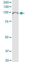 Anti-EPB41L1 Rabbit Polyclonal Antibody