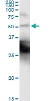 Anti-CK18 Antibody Pair