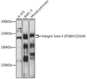 Western blot analysis of extracts of various cells, using Anti-Integrin beta 4 Antibody (A8487) at 1:1,000 dilution The secondary antibody was Goat Anti-Rabbit IgG H&L Antibody (HRP) at 1:10,000 dilution Lysates/proteins were present at 25 µg per lane