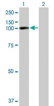 Anti-EPB41L1 Rabbit Polyclonal Antibody