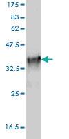 Anti-TLR7 Mouse Monoclonal Antibody [clone: 1G8]