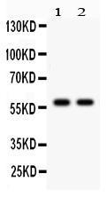 Anti-CYP1A2 Rabbit Polyclonal Antibody